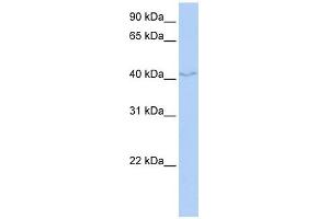 FAM50B antibody used at 1 ug/ml to detect target protein. (FAM50B 抗体  (N-Term))