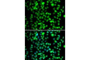 Immunofluorescence analysis of A-549 cells using FKBP6 antibody. (FKBP6 抗体  (AA 1-327))