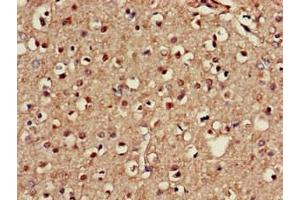 Immunohistochemistry of paraffin-embedded human brain tissue using ABIN7146747 at dilution of 1:100 (NOS1AP 抗体  (C-Term))