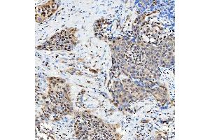 IHC analysis of SNRNP27 using anti-SNRNP27 antibody (ABIN7599614).