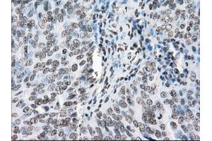 Immunohistochemical staining of paraffin-embedded endometrium tissue using anti-PORmouse monoclonal antibody. (POR 抗体)