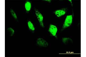 Immunofluorescence of monoclonal antibody to TCF4 on HeLa cell. (TCF4 抗体  (AA 1-365))