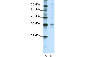 WB Suggested Anti-CRSP8 Antibody Titration:  5. (MED27 抗体  (C-Term))
