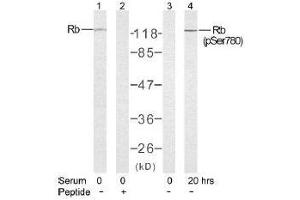Image no. 2 for anti-Retinoblastoma 1 (RB1) (Ser780) antibody (ABIN197285) (Retinoblastoma 1 抗体  (Ser780))