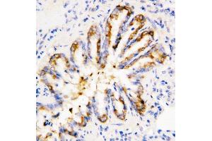 Anti-Calpain 1 antibody, IHC(P) IHC(P): Rat Lung Tissue (CAPNL1 抗体  (Middle Region))