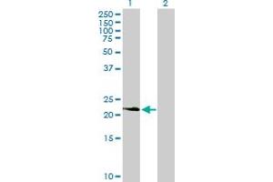 Western Blot analysis of PDGFA expression in transfected 293T cell line by PDGFA MaxPab polyclonal antibody. (PDGFA 抗体  (AA 1-211))