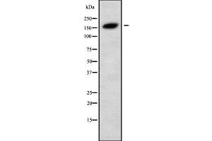 Western blot analysis of PLCH2 using MCF7 whole cell lysates (PLCH2 抗体  (N-Term))