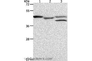 Western blot analysis of K562 cell and mouse heart tissue, MCF7 cell, using PSMD6 Polyclonal Antibody at dilution of 1:900 (PSMD6 抗体)