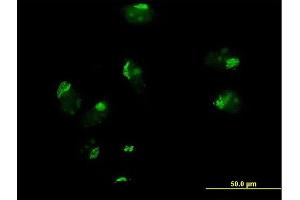 Immunofluorescence of purified MaxPab antibody to GOSR1 on HeLa cell.