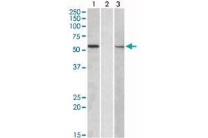 HEK293 lysate (10 ug protein in RIPA buffer) overexpressing human MGAT1 with C-terminal MYC tag probed with MGAT1 polyclonal antibody (Cat # PAB18956, 1 ug/mL) in Lane A and probed with anti-MYC Tag (1/1000) in lane C. (MGAT1 抗体  (Internal Region))