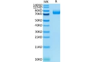 SDS-PAGE (SDS) image for CD36 (CD36) (AA 30-439) protein (His tag) (ABIN7274169)