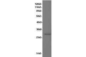 Western Blotting (WB) image for anti-Interleukin 10 (IL10) antibody (ABIN5957052) (IL-10 抗体)