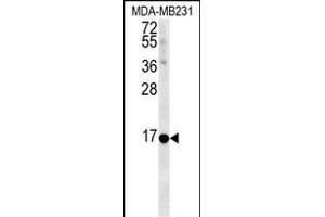 NMB Antibody (Center) (ABIN651541 and ABIN2840290) western blot analysis in MDA-M cell line lysates (35 μg/lane). (Neuromedin B 抗体  (AA 15-42))