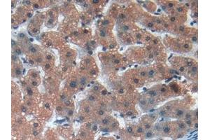 Detection of MMP12 in Human Liver Tissue using Polyclonal Antibody to Matrix Metalloproteinase 12 (MMP12)