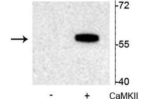 Western blot of recombinant tryptophan hydroxylase incubated in the absence (-) and presence (+) of  Ca2+/calmodulin dependent kinase II showing specific immunolabeling of the ~55 kDa tryptophan hydroxylase protein phosphorylated at Ser19. (Tryptophan Hydroxylase 2 抗体  (pSer19))