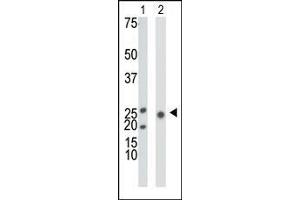 The anti-KHK Pab is used in Western blot to detect KHK in mouse liver tissue lysate (Lane 1) and 293 cell lysate (Lane 2). (Ketohexokinase 抗体  (N-Term))