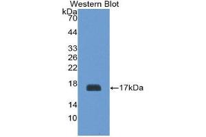 Western Blotting (WB) image for anti-Glycoprotein Ib (Platelet), beta Polypeptide (GP1BB) (AA 53-176) antibody (ABIN1868212) (GP1BB 抗体  (AA 53-176))