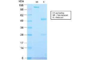 SDS-PAGE Analysis Purified PLAP Rabbit Recombinant Monoclonal Antibody (ALPP/2899R). (Recombinant PLAP 抗体)