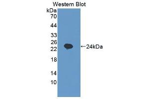 Western blot analysis of the recombinant protein. (SHBG 抗体  (AA 44-222))