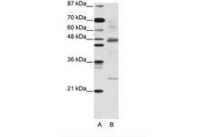 Image no. 2 for anti-NF-kappa-B inhibitor beta (NFKBIB) (AA 282-331) antibody (ABIN203071) (NFKBIB 抗体  (AA 282-331))
