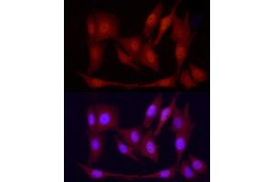 Immunofluorescence analysis of PC-12 cells using PGC1α Rabbit pAb  at dilution of 1:100 (40x lens). (PPARGC1A 抗体  (C-Term))