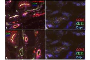 Immunofluorescence staining of Human foreskin (Cryo-section of unfixed tissue) with anti-CCM1 Antibody Cat. (KRIT1 抗体  (N-Term))