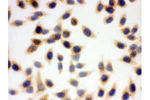 IHC analysis of SOD2  using anti-SOD2  antibody .