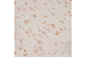 Immunohistochemistry of paraffin-embedded rat brain using  antibody (ABIN6129209, ABIN6137382, ABIN6137383 and ABIN6219595) at dilution of 1:100 (40x lens). (AXIN2 抗体  (AA 650-750))