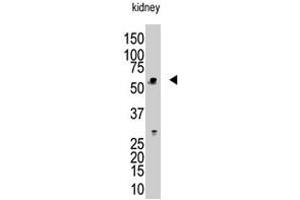 The RBCK1 polyclonal antibody  is used in Western blot to detect RBCK1 in mouse kidney tissue lysate. (RBCK1 抗体  (N-Term))