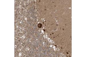 Immunohistochemical staining (Formalin-fixed paraffin-embedded sections) of human cerebellum with ALS2CR8 polyclonal antibody  shows strong cytoplasmic and nucleolar positivity in Purkinje cells. (Calcium Responsive Transcription Factor (CARF) 抗体)