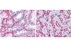 Immunohistochemistry of Rabbit Anti-Collagen IV Biotin Conjugated Antibody.