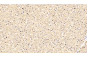 Immunohistochemistry (IHC) image for anti-Tumor Necrosis Factor Receptor Superfamily, Member 19 (TNFRSF19) (AA 35-160) antibody (ABIN7443233)