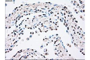 Image no. 4 for anti-Polo-Like Kinase 1 (PLK1) antibody (ABIN1500282)