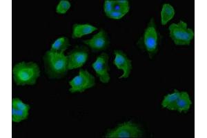 Immunofluorescent analysis of MCF-7 cells using ABIN7149603 at dilution of 1:100 and Alexa Fluor 488-congugated AffiniPure Goat Anti-Rabbit IgG(H+L) (DOCK8 抗体  (AA 1900-2099))