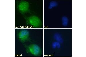 ABIN184938 Immunofluorescence analysis of paraformaldehyde fixed U251 cells, permeabilized with 0. (STRADB 抗体  (C-Term))