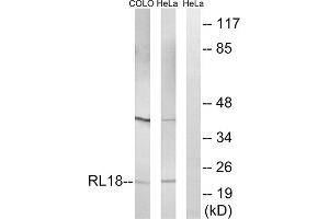 Western blot analysis of extracts from COLO cells and HeLa cells, using RPL18 antibody. (RPL18 抗体  (Internal Region))