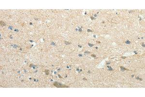 Immunohistochemistry of paraffin-embedded Human brain using SIRT3 Polyclonal Antibody at dilution of 1:30 (SIRT3 抗体)