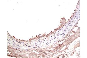 Formalin-fixed and paraffin-embedded rat Carotid artery labeled with Rabbit Anti-IGF-I Polyclonal Antibody , Unconjugated at 1:200 followed by conjugation to the secondary antibody and DAB staining
