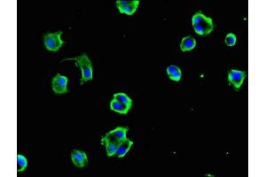 Immunofluorescent analysis of MCF-7 cells using ABIN7149312 at dilution of 1:100 and Alexa Fluor 488-congugated AffiniPure Goat Anti-Rabbit IgG(H+L) (DYNC1H1 抗体  (AA 12-66))