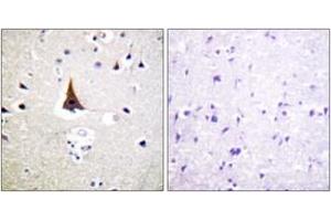 Immunohistochemistry analysis of paraffin-embedded human brain tissue, using VAV2 (Ab-142) Antibody. (VAV2 抗体  (AA 108-157))