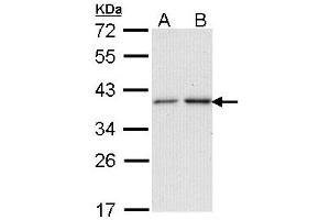 Western Blotting (WB) image for anti-N-Acetyltransferase 2 (Arylamine N-Acetyltransferase) (NAT2) (AA 1-168) antibody (ABIN467624) (NAT2 抗体  (AA 1-168))
