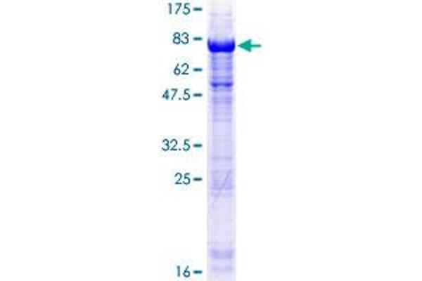 TSSC1 Protein (AA 1-387) (GST tag)