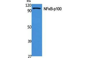 Western Blot (WB) analysis of specific cells using NFkappaB-p100 Polyclonal Antibody. (NFKB2 抗体  (Thr160))