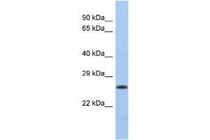 Western Blotting (WB) image for anti-Polymerase (DNA Directed), lambda (POLL) (Middle Region) antibody (ABIN2785954) (POLL 抗体  (Middle Region))