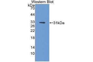 Western blot analysis of the recombinant protein. (DCT 抗体  (AA 28-263))