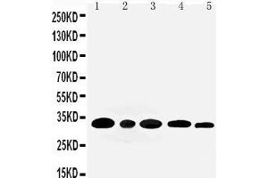 Anti-Aquaporin 3 antibody, Western blotting Lane 1: Rat Kidney Tissue Lysate Lane 2: Rat Lung Tissue Lysate Lane 3: Mouse Kidney Tissue Lysate Lane 4: M453 Cell Lysate Lane 5: MMC Cell Lysate (AQP3 抗体  (C-Term))