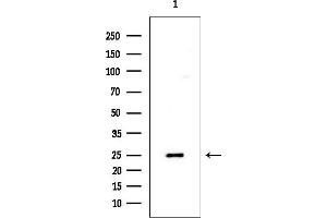 Western blot analysis of lysates from HUVEC cells, using PGP9.
