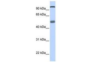 Image no. 1 for anti-DEAH (Asp-Glu-Ala-His) Box Polypeptide 32 (DHX32) (N-Term) antibody (ABIN6740491) (DHX32 抗体  (N-Term))