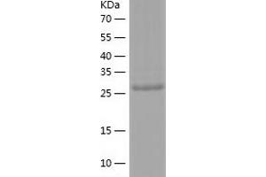 Caspase 1 Protein (CASP1) (AA 120-404) (His tag)