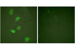 Immunofluorescence analysis of HeLa cells, using HDAC3 (Ab-424) Antibody. (HDAC3 抗体  (AA 379-428))